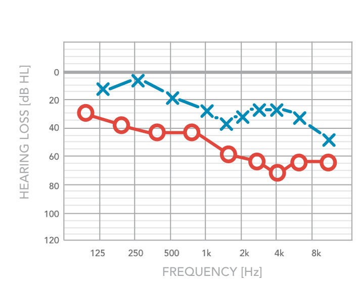 Audiogram